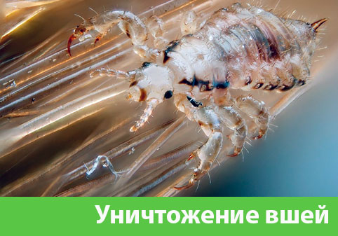Уничтожение вшей в городе Саранск